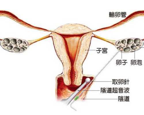 网友分享在南宁做四维彩超攻略,长期不孕去生殖中心要做哪些检查？